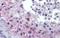 Rhox homeobox family member 2 antibody, A10718, Boster Biological Technology, Immunohistochemistry paraffin image 