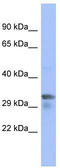 Pim-1 Proto-Oncogene, Serine/Threonine Kinase antibody, TA337682, Origene, Western Blot image 