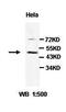 Ubiquitin Conjugating Enzyme E2 Q1 antibody, orb77618, Biorbyt, Western Blot image 