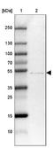 Zinc Finger DHHC-Type Containing 1 antibody, NBP2-13539, Novus Biologicals, Immunohistochemistry frozen image 