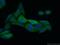 PTAC58 antibody, 10819-1-AP, Proteintech Group, Immunofluorescence image 