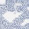 Sperm acrosome membrane-associated protein 3 antibody, HPA023633, Atlas Antibodies, Immunohistochemistry paraffin image 