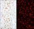 Zinc Finger CCHC-Type Containing 8 antibody, A301-805A, Bethyl Labs, Immunofluorescence image 