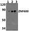 Zinc Finger Protein 600 antibody, PA5-75947, Invitrogen Antibodies, Western Blot image 