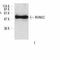 Cbfa1 antibody, LS-C178243, Lifespan Biosciences, Western Blot image 