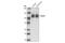 Glutamate Ionotropic Receptor NMDA Type Subunit 1 antibody, 5704S, Cell Signaling Technology, Western Blot image 
