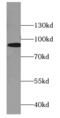 BMP/Retinoic Acid Inducible Neural Specific 1 antibody, FNab02254, FineTest, Western Blot image 