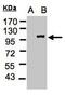 Importin 13 antibody, MBS9408797, MyBioSource, Western Blot image 