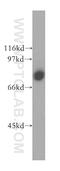 CD86 antibody, 13395-1-AP, Proteintech Group, Western Blot image 