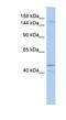 Ski2 Like RNA Helicase antibody, NBP1-57119, Novus Biologicals, Western Blot image 