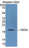 Superoxide Dismutase 1 antibody, LS-C724757, Lifespan Biosciences, Western Blot image 