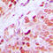GATA Binding Protein 1 antibody, abx133110, Abbexa, Western Blot image 