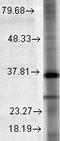 ST8 Alpha-N-Acetyl-Neuraminide Alpha-2,8-Sialyltransferase 2 antibody, LS-C227473, Lifespan Biosciences, Western Blot image 