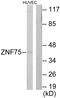 Zinc Finger Protein 75D antibody, PA5-38622, Invitrogen Antibodies, Western Blot image 