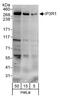 Inositol 1,4,5-Trisphosphate Receptor Type 1 antibody, A302-157A, Bethyl Labs, Western Blot image 