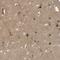 ALK Receptor Tyrosine Kinase antibody, HPA010694, Atlas Antibodies, Immunohistochemistry frozen image 