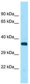 Serine/Threonine Kinase 33 antibody, TA331232, Origene, Western Blot image 