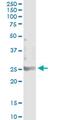 Spermatogenesis And Oogenesis Specific Basic Helix-Loop-Helix 2 antibody, MA5-22081, Invitrogen Antibodies, Immunoprecipitation image 