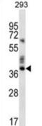 Olfactory Receptor Family 9 Subfamily K Member 2 antibody, abx026694, Abbexa, Western Blot image 