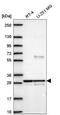 Yip1 Domain Family Member 5 antibody, NBP2-57970, Novus Biologicals, Western Blot image 