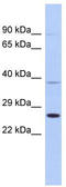 Secretion Associated Ras Related GTPase 1B antibody, TA336024, Origene, Western Blot image 