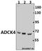 Uncharacterized aarF domain-containing protein kinase 4 antibody, A32263, Boster Biological Technology, Western Blot image 