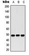 Histone Deacetylase 3 antibody, LS-C359014, Lifespan Biosciences, Western Blot image 