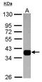 Aldo-Keto Reductase Family 1 Member B10 antibody, PA5-30773, Invitrogen Antibodies, Western Blot image 