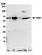 TBC1 Domain Family Member 10A antibody, A304-587A, Bethyl Labs, Western Blot image 