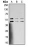 Mitogen-Activated Protein Kinase 8 antibody, LS-C368406, Lifespan Biosciences, Western Blot image 