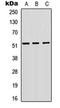 Vasoactive Intestinal Peptide Receptor 1 antibody, orb304660, Biorbyt, Western Blot image 