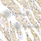 Chaperonin Containing TCP1 Subunit 3 antibody, A6547, ABclonal Technology, Immunohistochemistry paraffin image 