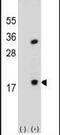 Phospholipase A2 Group IB antibody, PA5-24805, Invitrogen Antibodies, Western Blot image 