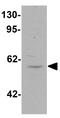 Hedgehog Acyltransferase Like antibody, GTX32068, GeneTex, Western Blot image 