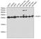 Protein-L-Isoaspartate (D-Aspartate) O-Methyltransferase antibody, GTX33392, GeneTex, Western Blot image 