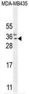 Heat Shock Protein Nuclear Import Factor Hikeshi antibody, AP50933PU-N, Origene, Western Blot image 
