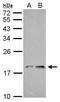 NADH:Ubiquinone Oxidoreductase Subunit AB1 antibody, GTX111875, GeneTex, Western Blot image 