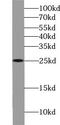 Ubiquitin Conjugating Enzyme E2 E3 antibody, FNab09172, FineTest, Western Blot image 
