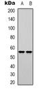 DNA Polymerase Mu antibody, orb339057, Biorbyt, Western Blot image 
