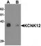 Potassium Two Pore Domain Channel Subfamily K Member 12 antibody, TA319968, Origene, Western Blot image 