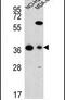 Fumarylacetoacetate Hydrolase Domain Containing 2A antibody, PA5-25845, Invitrogen Antibodies, Western Blot image 