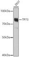 Tumor Protein P73 antibody, 13-160, ProSci, Western Blot image 