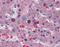 CELF1 antibody, A02163-1, Boster Biological Technology, Immunohistochemistry paraffin image 