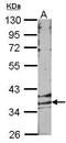 Probable G-protein coupled receptor 146 antibody, GTX100011, GeneTex, Western Blot image 