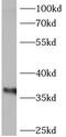 Annexin A4 antibody, FNab00434, FineTest, Western Blot image 