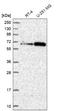 UBX Domain Protein 7 antibody, NBP2-47589, Novus Biologicals, Western Blot image 