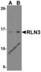 Relaxin 3 antibody, 8181, ProSci Inc, Western Blot image 