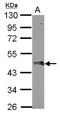 F-Box Protein 4 antibody, NBP2-21608, Novus Biologicals, Western Blot image 