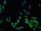 LCK Proto-Oncogene, Src Family Tyrosine Kinase antibody, A56046-100, Epigentek, Immunofluorescence image 