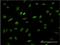 Acidic Nuclear Phosphoprotein 32 Family Member B antibody, H00010541-M05, Novus Biologicals, Immunocytochemistry image 